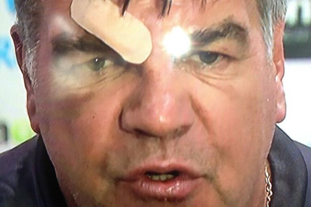Sam-Allardyce-during-his-press-conference-after-a-fall-at-Aintree-1813351.jpg