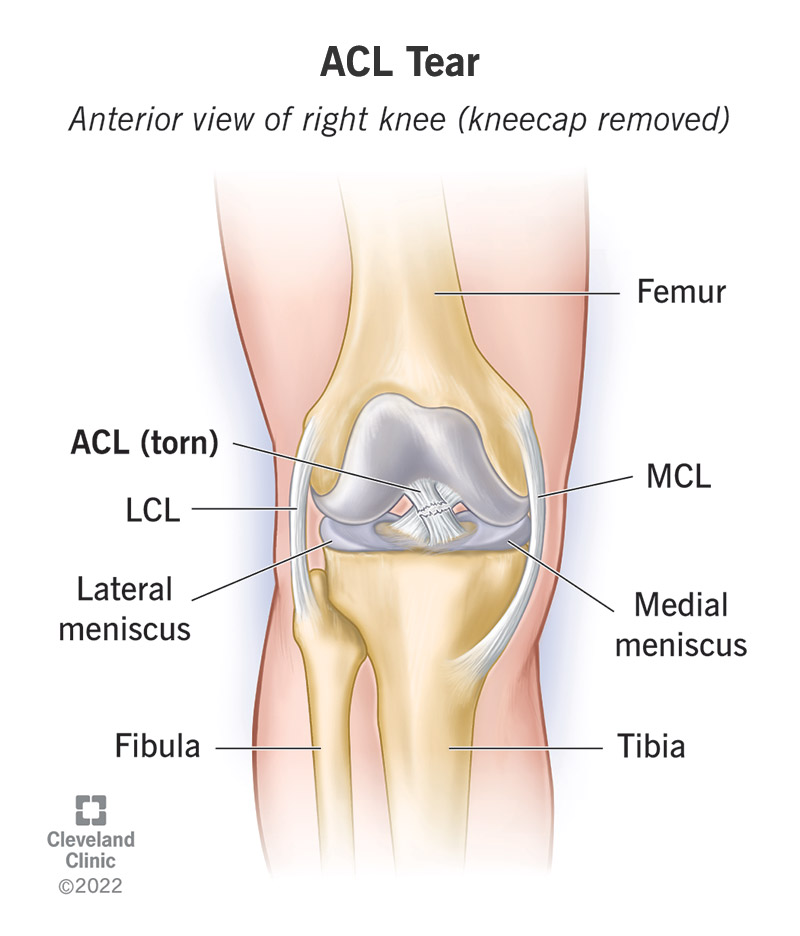 my.clevelandclinic.org