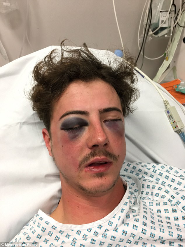 3FA5E5DE00000578-4450480-Tottenham_supporter_Michael_Voller_23_suffered_a_broken_skull_ch-a-3_1493275445700.jpg